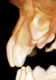 Lagediagnose Zahn